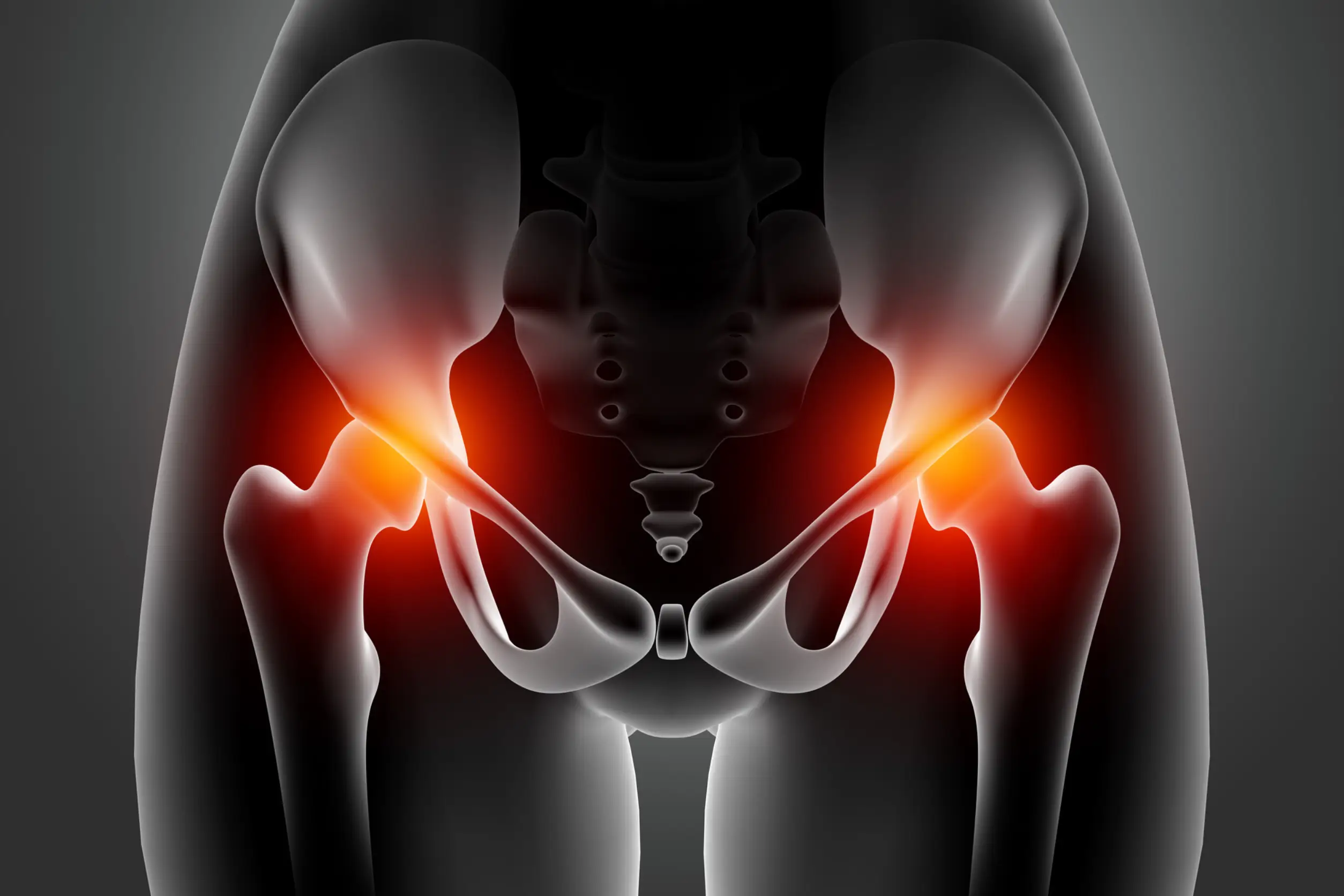 Sciatica Acupuncture Sciatica Acupuncture